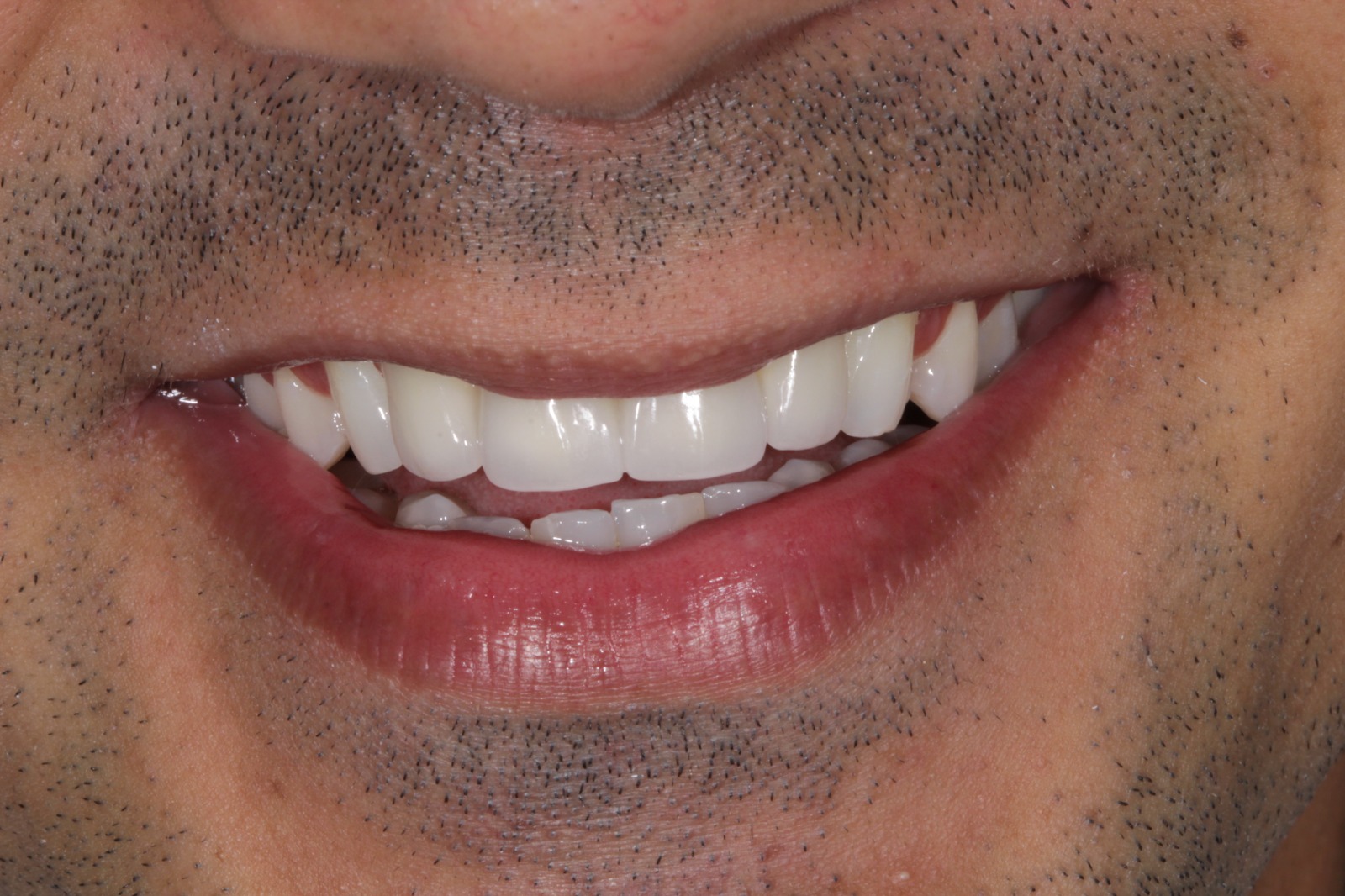 WhatsApp Image 2025-04-28 at 13.08.27 (2)