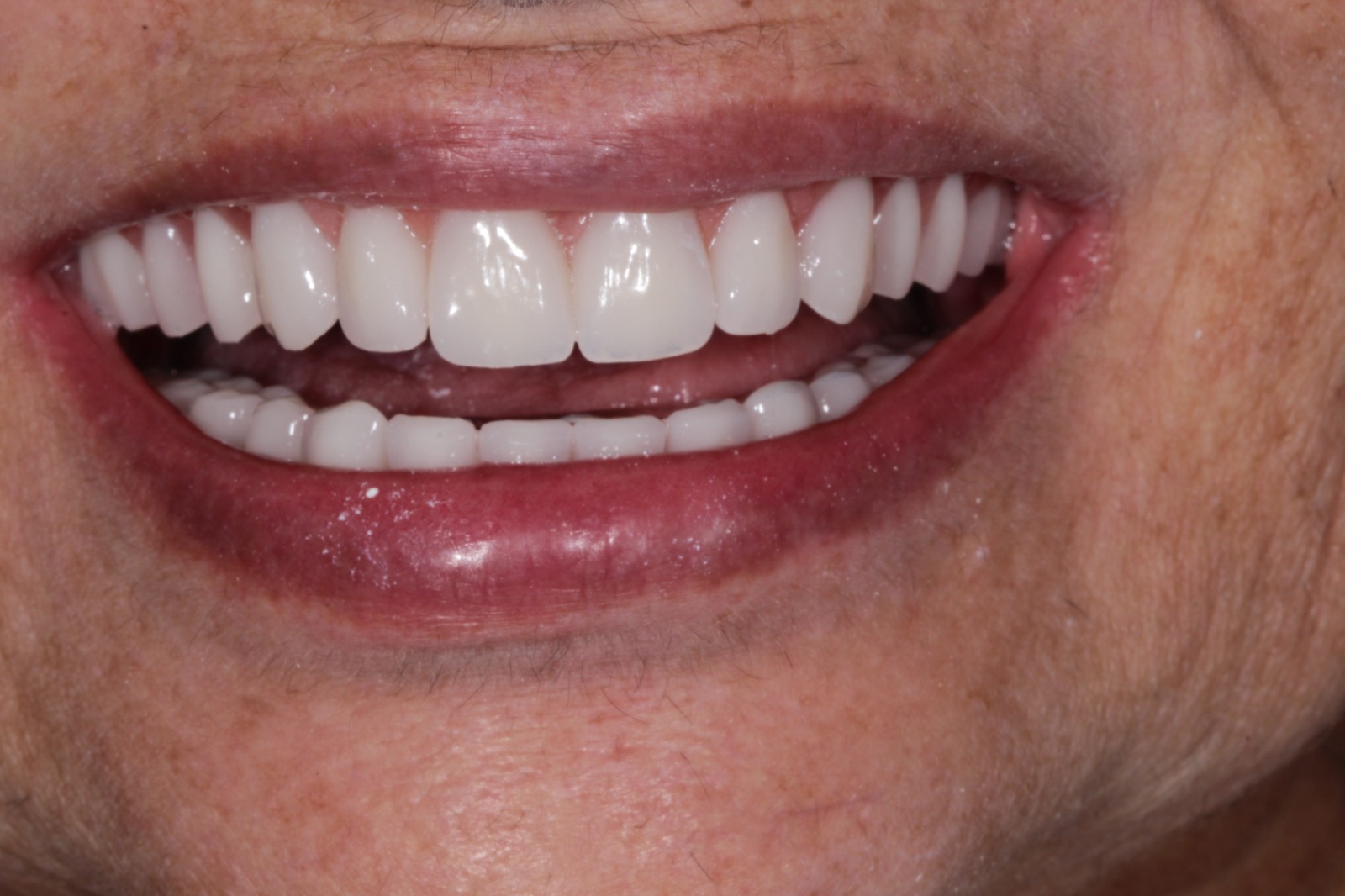 WhatsApp Image 2025-04-28 at 13.08.31 (3)