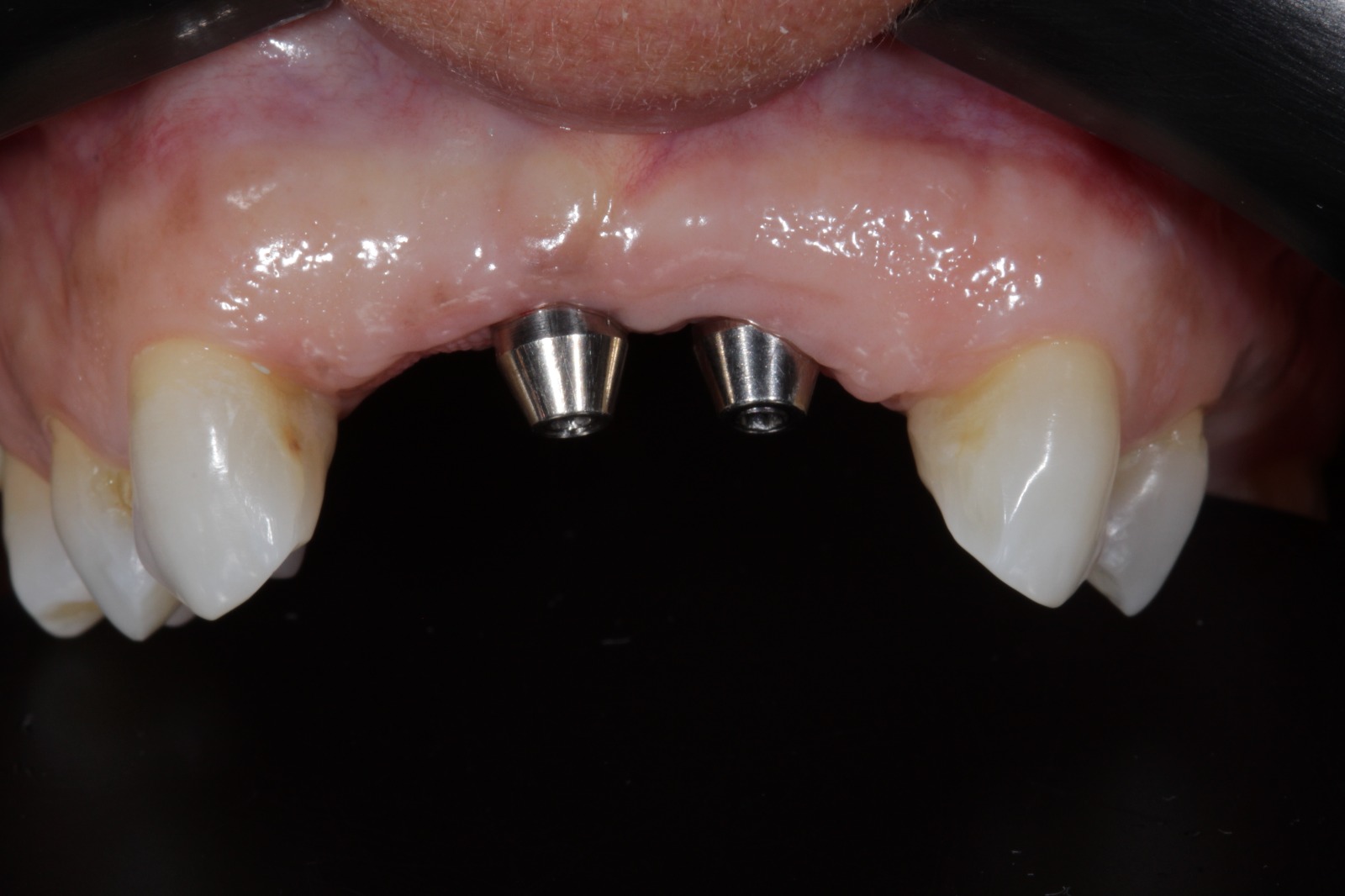 WhatsApp Image 2025-04-28 at 13.08.34 (5)