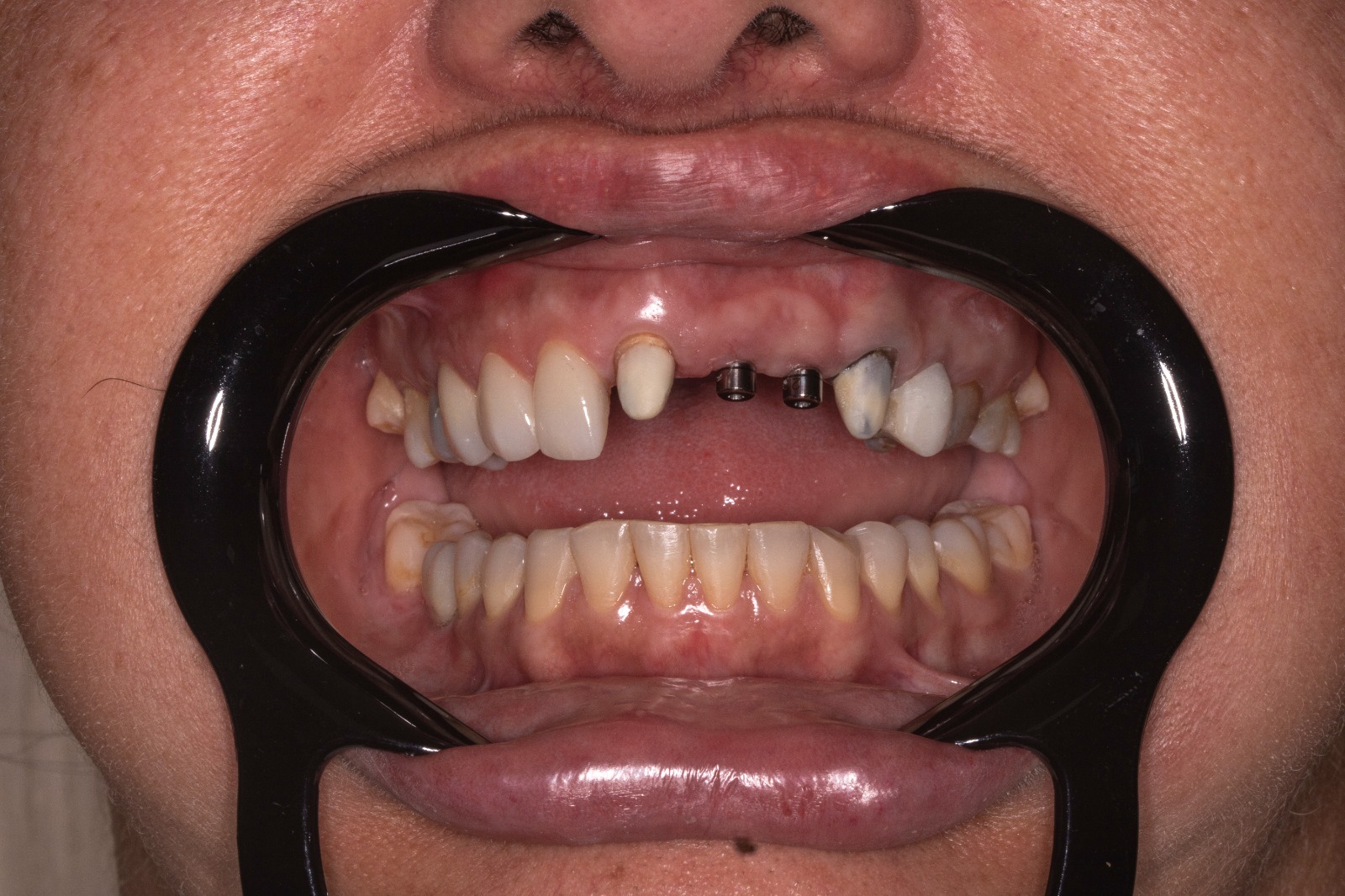 WhatsApp Image 2025-04-28 at 13.08.35 (4)