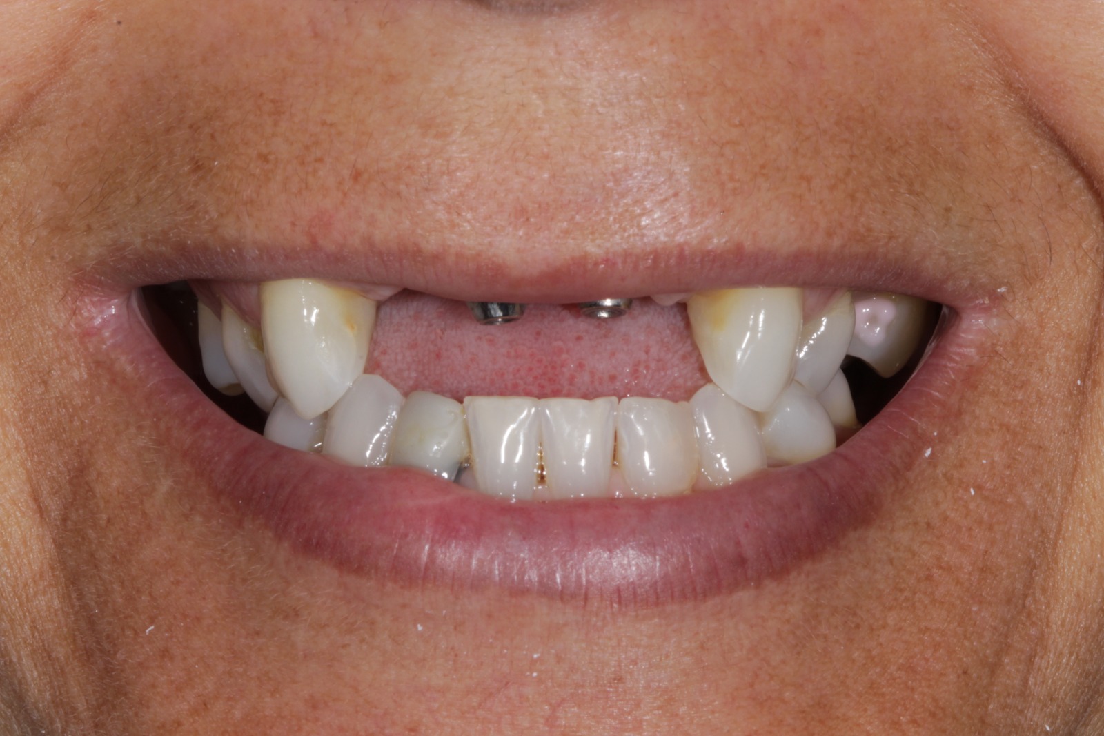 WhatsApp Image 2025-04-28 at 13.08.35