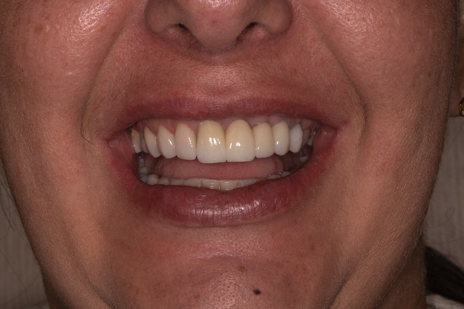 WhatsApp Image 2025-04-28 at 13.08.36 (3)